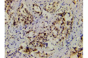 Immunohistochemistry (IHC) image for anti-LIM Domain Kinase 1 (LIMK1) (pThr508) antibody (ABIN6255701)