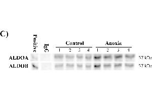 Western Blotting (WB) image for anti-Aldolase B, Fructose-Bisphosphate (ALDOB) antibody (ABIN2855024)