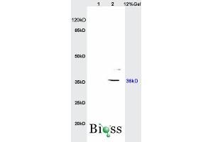 SDS-PAGE (SDS) image for anti-Insulin-Like Growth Factor Binding Protein 2, 36kDa (IGFBP2) (AA 101-200) antibody (ABIN737781)