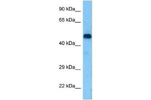 Host:  Rat  Target Name:  RIPK3  Sample Tissue:  Rat Brain  Antibody Dilution:  1ug/ml (RIPK3 Antikörper  (Middle Region))
