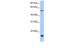 Image no. 1 for anti-CKLF-Like MARVEL Transmembrane Domain Containing 8 (CMTM8) (C-Term) antibody (ABIN6739410) (CMTM8 Antikörper  (C-Term))