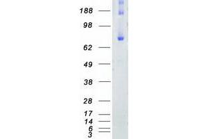 Western Blotting (WB) image for Fermitin Family Member 2 (FERMT2) (Transcript Variant 1) protein (Myc-DYKDDDDK Tag) (ABIN2721014)