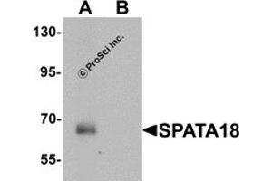 Western Blotting (WB) image for anti-Spermatogenesis Associated 18 (SPATA18) (N-Term) antibody (ABIN1031583) (SPATA18 Antikörper  (N-Term))