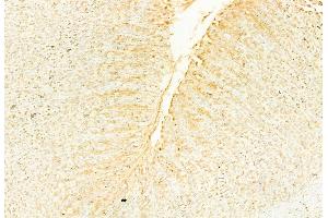 ABIN6266354 and ABIN6276702 at 1/100 staining Rat stomach tissue by IHC-P.
