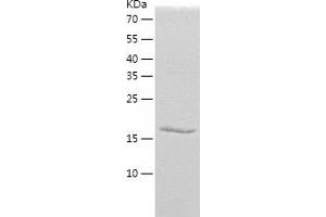 Protein Phosphatase 1, Regulatory (Inhibitor) Subunit 2 (PPP1R2) (AA 1-166) protein (His tag)