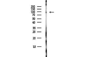 Western blot analysis of lysates from COLO205 cells(heat-shock,45 min treatment), using ATP6V0 Antibody at 1/1000 dilution.