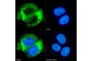 Immunofluorescence staining of fixed A431 cells with anti-CD63 antibody NK-1-C3. (Rekombinanter CD63 Antikörper)