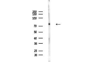 Western blot analysis of lysates from Hela cells(heat-shock,45 min treatment), using Phospho-RSK2 (Ser386) Antibody at 1/1000 dilution.