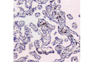 IHC analysis of DC-SIGN using anti-DC-SIGN antibody . (DC-SIGN/CD209 Antikörper)