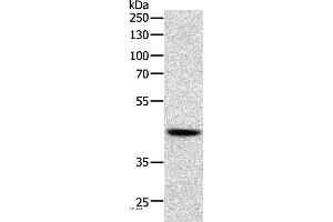 Western blot analysis of Human lymphoma tissue, using SOX7 Polyclonal Antibody at dilution of 1:750 (SOX7 Antikörper)