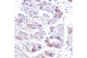 Immunohistochemistry (IHC) image for anti-Nuclear Receptor Subfamily 3, Group C, Member 2 (NR3C2) (C-Term) antibody (ABIN1681109)