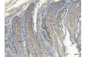 ABIN6255832 and ABIN6267103 at 1/100 staining human normal colon tissue by IHC-P.