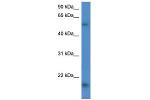 WB Suggested Anti-GPT2 Antibody Titration:  0. (GPT2 Antikörper  (C-Term))