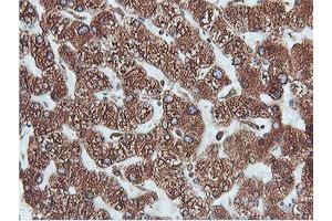 Immunohistochemical staining of paraffin-embedded Human liver tissue using anti-PDIA4 mouse monoclonal antibody. (PDIA4 Antikörper)