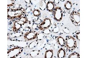 Immunohistochemistry (IHC) image for anti-Fumarylacetoacetate Hydrolase Domain Containing 2A (FAHD2A) antibody (ABIN1498183) (FAHD2A Antikörper)
