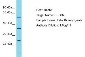 Host: Rabbit Target Name: SHOC2 Sample Tissue: Human Fetal Kidney Antibody Dilution: 1ug/ml (SHoc2/Sur8 Antikörper  (N-Term))