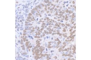 Immunohistochemistry (IHC) image for anti-Sp1 Transcription Factor (SP1) (C-Term) antibody (ABIN7458075)