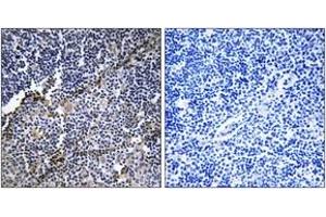 Immunohistochemistry analysis of paraffin-embedded human thymus gland tissue, using Collagen XIX alpha1 Antibody. (COL19A1 Antikörper  (AA 421-470))