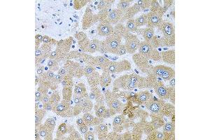 Immunohistochemistry of paraffin-embedded human liver injury using POMGNT1 antibody (ABIN6003611) at dilution of 1/100 (40x lens). (POMGNT1 Antikörper)