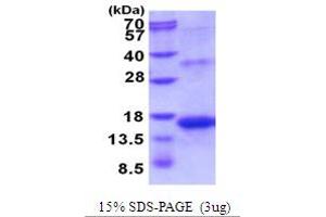 SDS-PAGE (SDS) image for Inhibin, beta A (INHBA) (AA 311-426) protein (His tag) (ABIN5854095) (INHBA Protein (AA 311-426) (His tag))