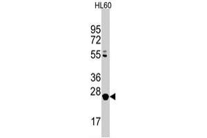 Western blot analysis of LIN28B polyclonal antibody  in HL-60 cell line lysates (35 ug/lane). (LIN28B Antikörper  (C-Term))