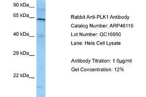Western Blotting (WB) image for anti-Polo-Like Kinase 1 (PLK1) (N-Term) antibody (ABIN2782495) (PLK1 Antikörper  (N-Term))