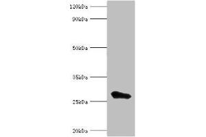 Western blot All lanes: MED6 antibody at 8 μg/mL + Jurkat whole cell lysate Secondary Goat polyclonal to rabbit IgG at 1/10000 dilution Predicted band size: 29, 30, 21 kDa Observed band size: 29 kDa (MED6 Antikörper  (AA 27-246))