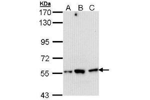 WB Image Sample (30 ug of whole cell lysate) A: Hep G2 , B: Molt-4 , C: Raji 7. (DARS Antikörper)