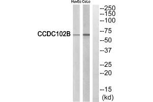 Western blot analysis of extracts from HuvEc cells and COLO cells, using CCDC102B antibody. (CCDC102B Antikörper  (Internal Region))