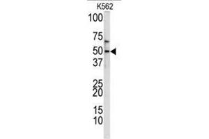 Western blot analysis of TIEG2 antibody (N-term) in K562 cell line lysates (35ug/lane).