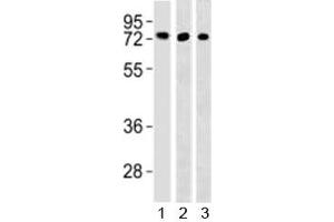 Western blot testing of TFE3 antibody and 1) HepG2, 293 and 3) mouse lung lysate (TFE3 Antikörper  (AA 1-30))