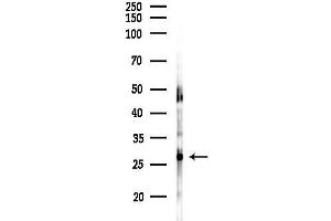anti-Stathmin-Like 4 (STMN4) (Internal Region) antibody