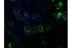 Anti-HIBCH mouse monoclonal antibody (ABIN2453127) immunofluorescent staining of COS7 cells transiently transfected by pCMV6-ENTRY HIBCH (RC209814). (HIBCH Antikörper)