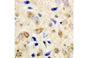Immunohistochemical analysis of NPY5R staining in human brain formalin fixed paraffin embedded tissue section. (NPY5R Antikörper)