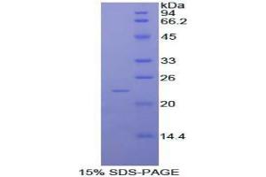 Non Metastatic Cells 6, Protein Expressed In protein
