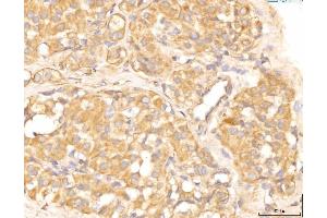 IHC analysis of EIF4B using anti-EIF4B antibody (ABIN7599496). (EIF4B Antikörper  (AA 1-611))
