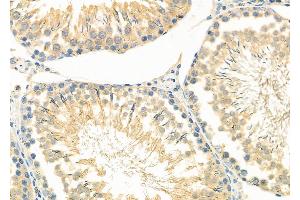 ABIN6261870 and ABIN6266696 at 1/100 staining Rat testis tissue by IHC-P.