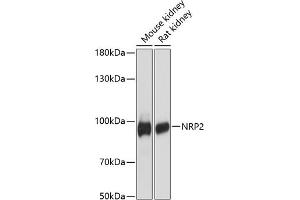 Western blot analysis of extracts of various cell lines, using NRP2 antibody (ABIN6128378, ABIN6144863, ABIN6144864 and ABIN6216499) at 1:3000 dilution. (NRP2 Antikörper  (AA 443-740))