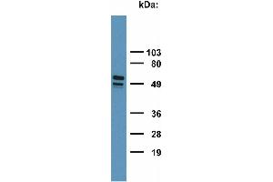 Detection of Cytokeratin 7+17 in HeLa cell lysate with monoclonal antibody.