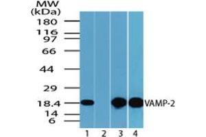 Image no. 1 for anti-Vesicle-Associated Membrane Protein 2 (Synaptobrevin 2) (VAMP2) (AA 1-50) antibody (ABIN960402) (VAMP2 Antikörper  (AA 1-50))