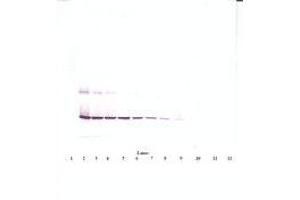 Image no. 2 for anti-Ciliary Neurotrophic Factor (CNTF) antibody (ABIN1497554) (CNTF Antikörper)