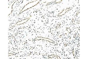 IHC analysis of splicing factor 1 using anti-splicing factor 1 antibody (ABIN7600194). (Splicing Factor 1 Antikörper  (AA 160-266))
