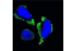 Confocal immunofluorescence analysis of Hela cells using PAK2 mouse mAb (green). (PAK2 Antikörper)