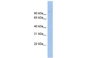 WB Suggested Anti-ABCB6 Antibody Titration:  0. (ABCB6 Antikörper  (Middle Region))