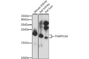 Western blot analysis of extracts of various cell lines, using TRA antibody (ABIN7270871) at 1:1000 dilution. (TRAPPC6A Antikörper  (AA 1-173))