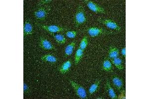 IF analysis of Hexokinase 1/HK1 using anti-Hexokinase 1/HK1 antibody (ABIN7600260). (Hexokinase 1 Antikörper  (AA 17-323))