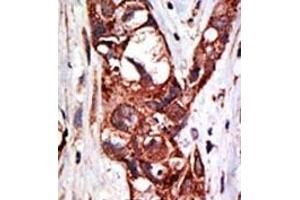 Image no. 1 for anti-SUMO1 Activating Enzyme Subunit 1 (SAE1) (C-Term) antibody (ABIN357744)