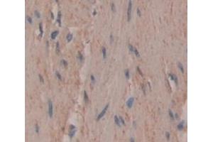 Used in DAB staining on fromalin fixed paraffin- embedded skeletal muscle tissue (UNG Antikörper  (AA 1-313))