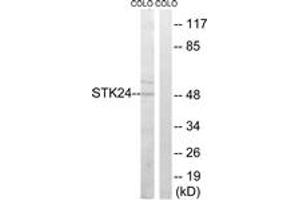 Western blot analysis of extracts from COLO cells, using STK24 Antibody. (STK24 Antikörper  (AA 319-368))
