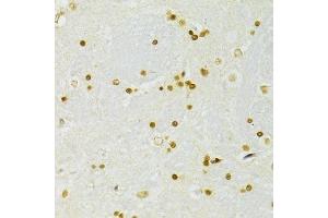 Immunohistochemistry (Paraffin-embedded Sections) (IHC (p)) image for anti-Adenosine Deaminase, RNA-Specific (ADAR) (AA 150-250) antibody (ABIN6136553)